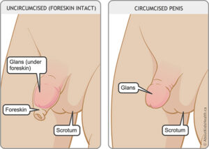 circumcised penis