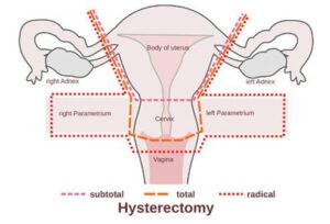 Sexual problems in women